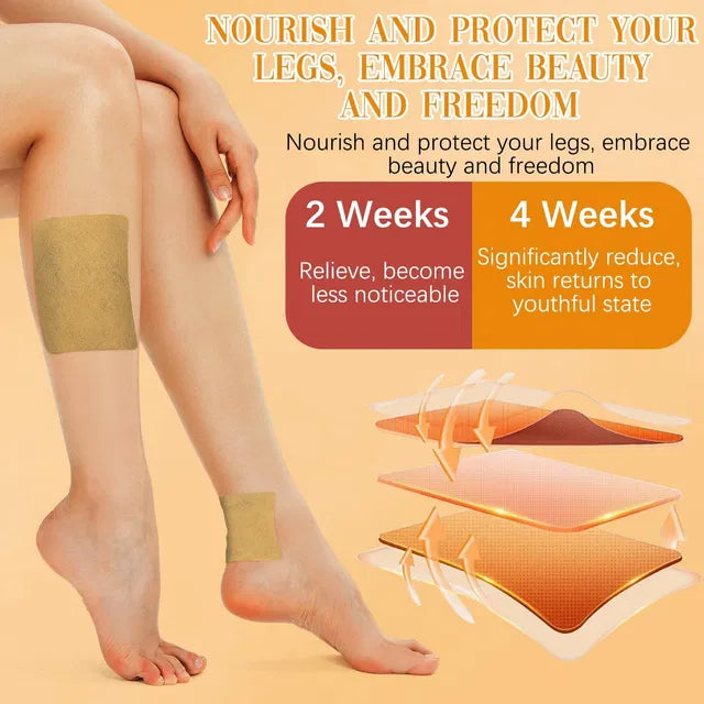 Turmeric Varicose Veins Treatment for Legs Patch, Naturally Relieves Varicose Veins in Legs and Spiders