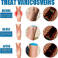 Vein Healing Varicose Veins Treatment Spray Pack of 2